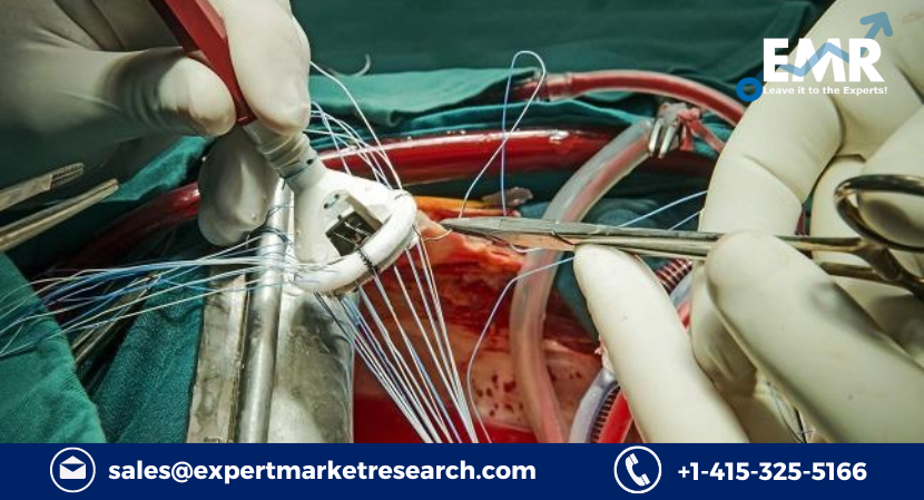 Aortic Valve Replacement Devices Market Growth